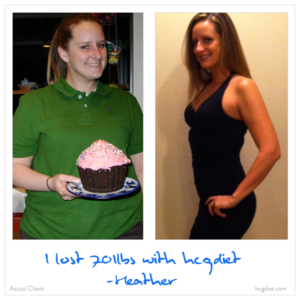 Hcg Diet Success Story - 70 pounds lost